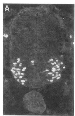 (Roelink et al, 1994) Camudongos com deleção para o gene Shh carecem de