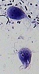 Diplomonadidos e parabasálios Perda evolutiva da aerobiose.