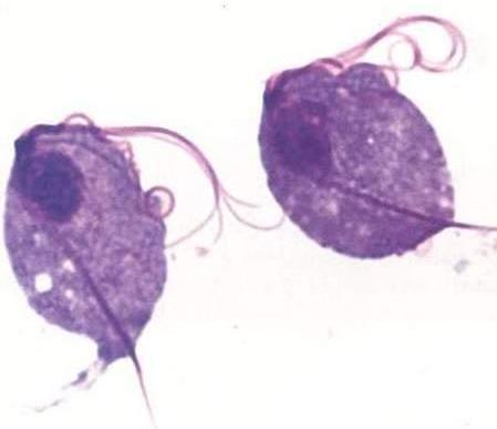 ATP em anaerobiose, liberando gás hidrogênio Trichomonas vaginalis 2)