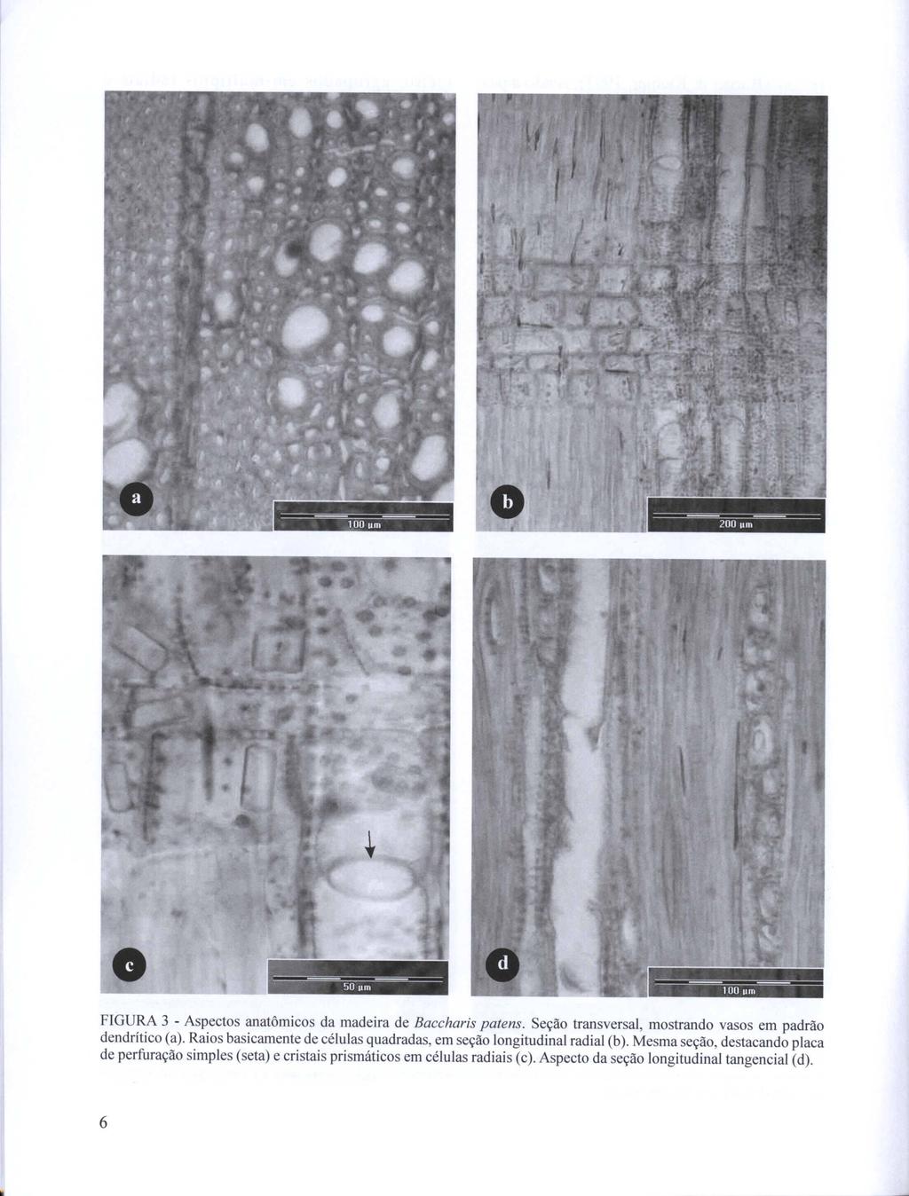 -- -- -- -- 100 um 200 um FIGURA 3 - Aspectos anatômicos da madeira de Baccharis patens. Seção transversal, mostrando vasos em padrão dendrítico (a).