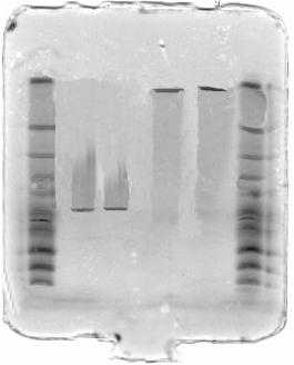 Capítulo III Os pontos isoeléctricos obtidos para as isoperoxidases aniónicas da azeitona preta foram 6,9 para as A1 e A2 e um valor próximo de 4,6 e 4,4 para as isoenzimas A3 e A4 respectivamente.