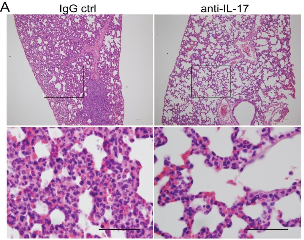 IL-17 controls neutrophil recruitment to secondary sites