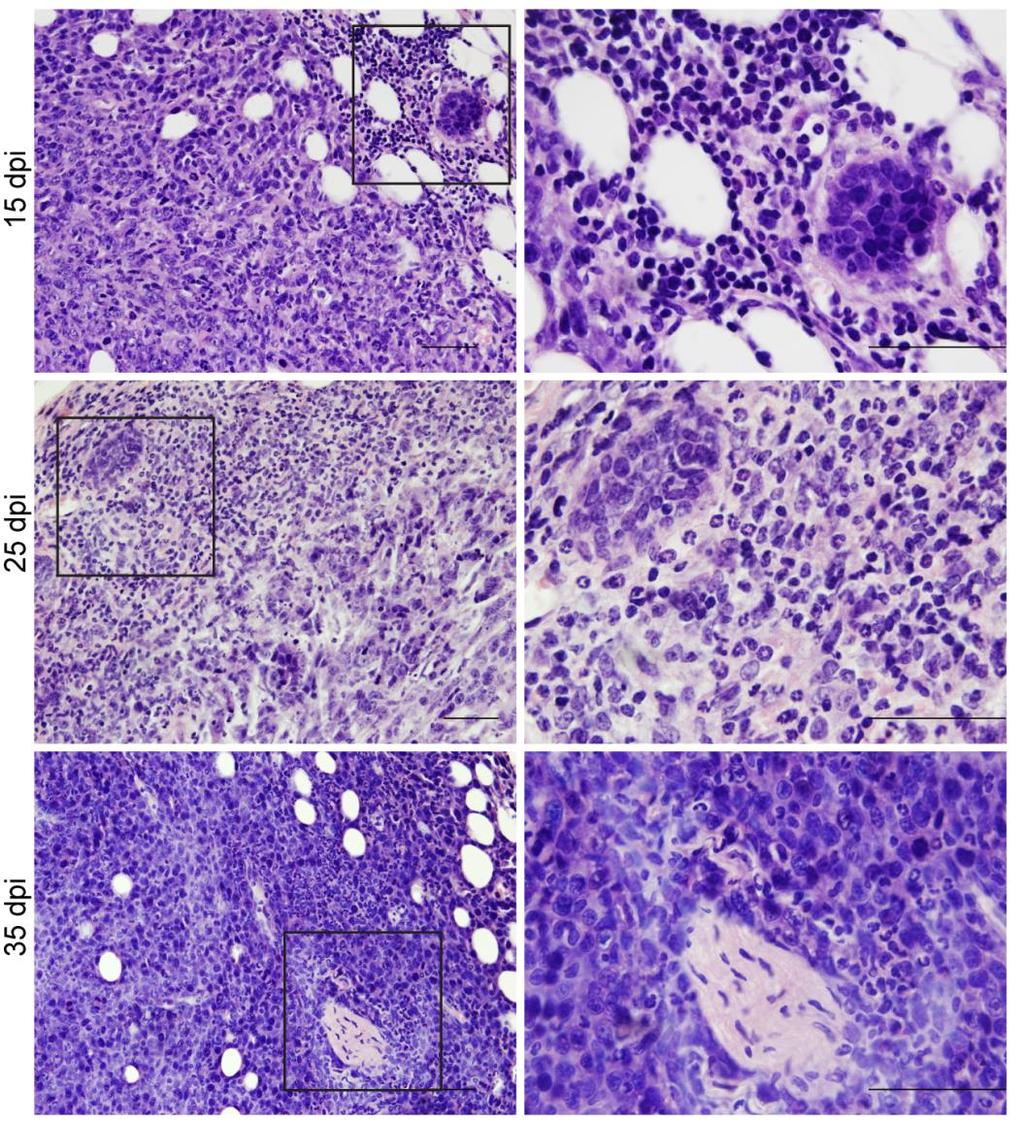 Presence of neutrophils in metastatic mammary