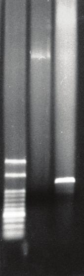 Disciplinarum Scientia. Série: Ciências da Saúde, Santa Maria, v. 16, n. 1, p. 11-17, 2015. 15 causadas por Shigella spp., auxiliados pelas metodologias moleculares empregadas.