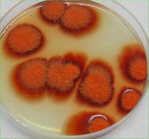 Foto: bioser.com Tipos de micotoxinas Citrinina Produzida principalmente pelos fungos Penicillium citrinum e P.
