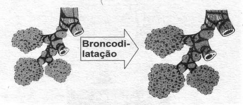 Dopamina Efeitos Adversos: Arritmias - taquicardia excessiva; Hipertensão - vasoconstrição indesejável; Reações adversas são fugazes rápida metabolização.