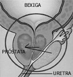 α- bloqueadores Efeitos Terapêuticos Efeitos no Trato geniturinário: tônus da musculatura lisa da próstata e do colo da bexiga fluxo urinário.