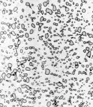 Microestruturas - Resfriamento Moderado BAINITA Ocorre a uma temperatura inferior a do joelho