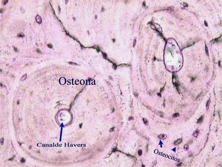 Tecido ósseo esponjoso Tecido ósseo compacto Tecido conjuntivo - ósseo Matriz óssea calcificada O