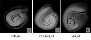 15 6 7 8 9 10 75% 78% 75% 75% 73% 4,3 cm 11 12 13 14 15 * Determidada