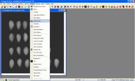 Image-Pro Plus: segmentação da imagem Imagem: Francisco G.