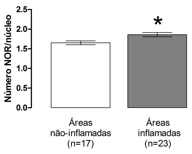 14 Gráfico 1: Número de NORs/núcleo em áreas que apresentavam regiões inflamadas e não inflamadas de CR e CRe.