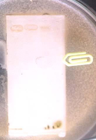 EE 160 R EEC 160 R EEB 40 S (Rf 0,31) R = Resistente S = Sensível Fig.3 : Antibiograma obtido por bioautografia de EE, EEC e EEB.