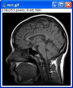 Médicas: ImageJ