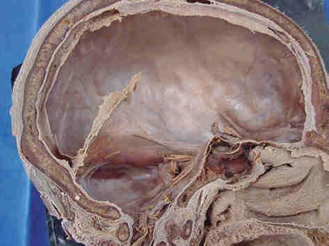 3 Crânio 55 não serão descritas). Esses vasos e nervos passam na base craniana através de orifícios ou forâmens (na realidade, canais e fendas ou fissuras).