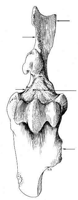 ARTICULAÇÕES SINOVIAIS -47- ARTICULAÇÃO ESCÁPULO- UMERAL Espinha da Escápula