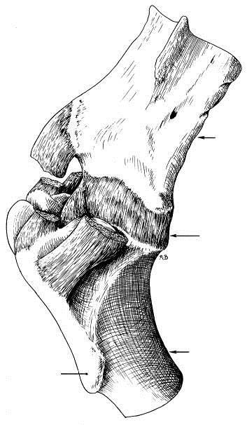 Tuberosidade Deltóide Úmero Tuberosidade Deltóide Úmero vista cranial vista