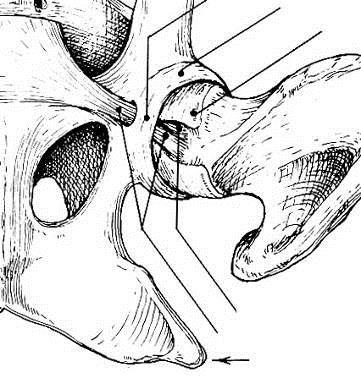 Acessório do Fêmur Ligamento transverso do acetábulo Cartilagem articular Classificação: Cotílica Movimentos: extensão,