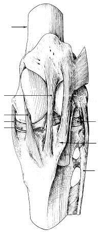 ARTICULAÇÕES SINOVIAIS -53- ARTICULAÇÃO FÊMURO-TIBIO-PATELAR Fêmur Ligamento patelar intermédio Ligamento patelar medial