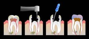 Endodontia É o ramo da Odontologia que estuda a morfologia, fisiologia e