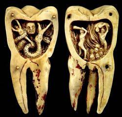 Em 1780, um artista do sul da França esculpiu em marfim uma réplica de um molar humano, com aproximadamente 10 centímetros de altura, que