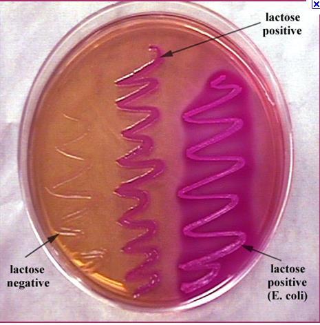 coli Proteus As bactérias