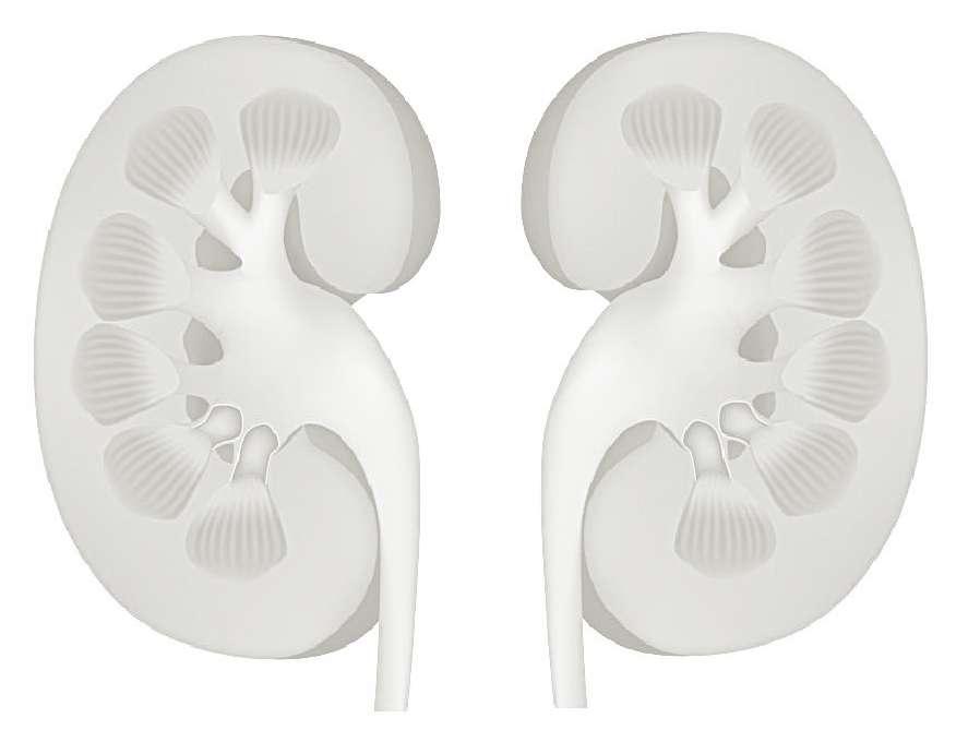 Cuidados de Enfermagem Renal Lesão Renal Aguda Atentar para alteração do fluxo urinário. Se micção espontânea oferecer comadre ou papagaio.