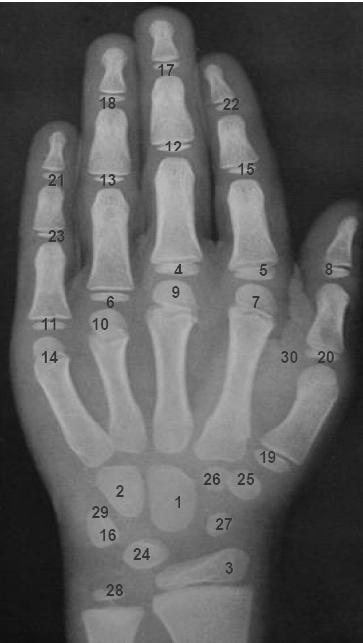 metacarpais/falanges na avaliação da maturidade óssea (Pietka, McNitt-Gray, Kuo, & Huang, 1991; Pietka, Kaabi, Kuo, & Huang, 1993).