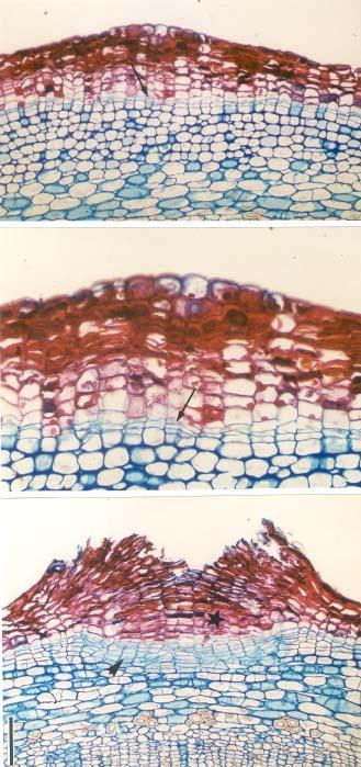Figura 9.12 - Sabugueiro (Sambucus sp.). Seção transversal caulinar com lenticela. A - Início de desenvolvimento, observando-se felogênio da lenticela (seta). Barra = 132 µm.