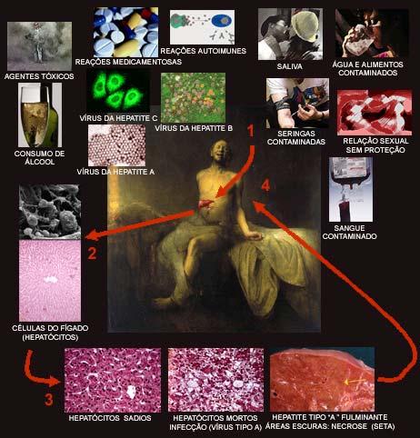 CONCEITO DE DOENÇA 1. CAUSA & MODO DE TRANSMISSÃO [ ETIOLOGIA ] 2. MECANISMO DA ALTERAÇÃO NA FUNÇÃO DO ÓRGÃO [ PATOGENIA & FISIOPATOLOGIA ] 3. ANATOMIA DA LESÕES [ ANATOMIA PATOLOGIA ] 4.