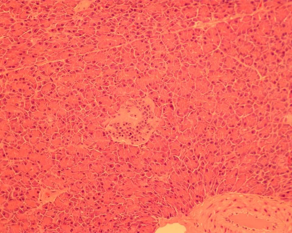 96 IL PA Figura 9 Fotomicrografia de um corte histológico de pâncreas bovino naturalmente infectado por E.