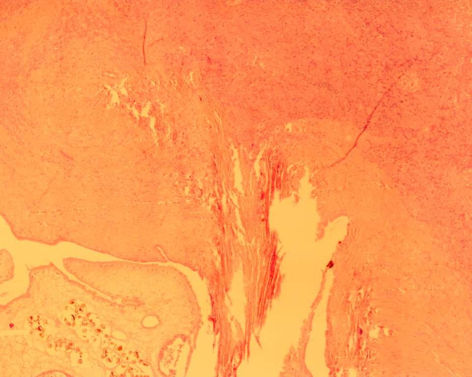 99 O R P Figura 12 Fotomicrografia de um corte histológico de pâncreas bovino naturalmente infectado por E.