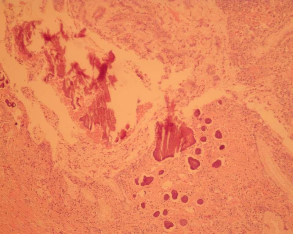 101 FI CD Figura 14 Fotomicrografia de um corte histológico de pâncreas bovino naturalmente infectado por E.