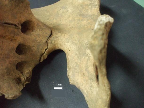 Estudo paleobiológico de uma amostra osteológica inumada em Santa Maria dos Olivais, Tomar O indivíduo SMOL-45-A1, classificado como adulto jovem e alofísico, tem uma linha muito ténue que aparenta