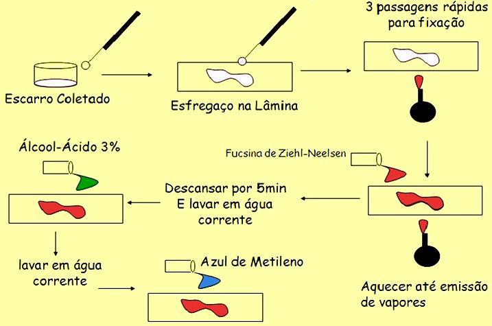 Coloração para baciloscopia Amostras Clínicas Exame Direto para pesquisa de BAAR (ou Bacilo de Koch)