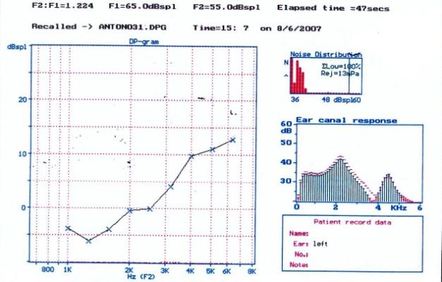 Após avaliação foi iniciado atendimento fonoaudiológico.