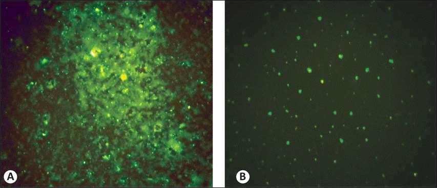 FIGURE 1 - Photomicrographs of direct immunofluorescence reactions in the presence (A and B) of rabies virus antigens in the brain tissue samples subjected to cryopreservation at -20 C for up to 2