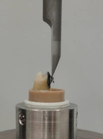 A posição do conjunto nos mordentes permitiu que o movimento de cisalhamento fosse paralelo à face vestibular do dente, imprimindo a força de cisalhamento na interface aleta-base do bráquete (Figura