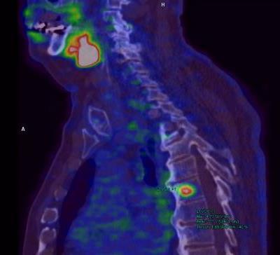 PET/CT 68