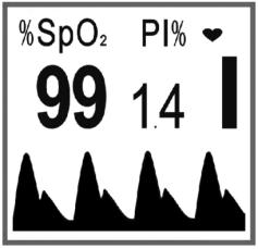 coração " ": Istogramma intensidade batimento "PI": Icona índice de perfusão; "1,4" Valor índice de perfusão 5.