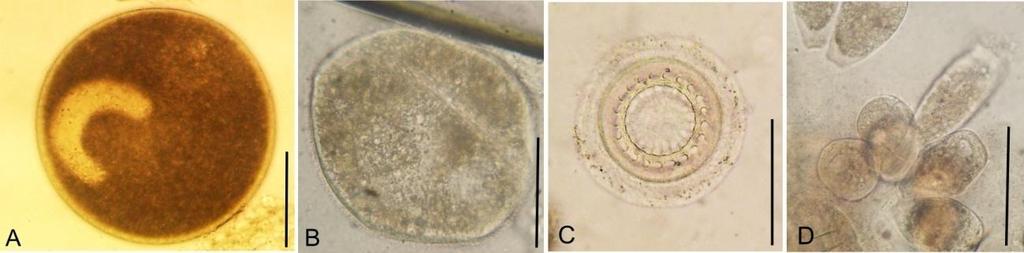 4.3.2 Avaliação parasitológica Foram observadas diversas prevalências e graus de infestação para os protozoários I. multifiliis, Trichodina sp., Chilodonella sp., Epistylis sp.