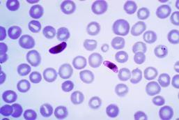 Vacinas contra parasitas Taenia solium mais de 3m Th2 IgE Plasmodium spp.