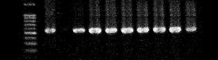 63 Figura 9: Eletroforegrama representativo da amplificação de segmento parcial do gene codificador para β-lactamase de espectro estendido blactx-m (562pb) em enterobactérias. Fonte: Arquivo pessoal.