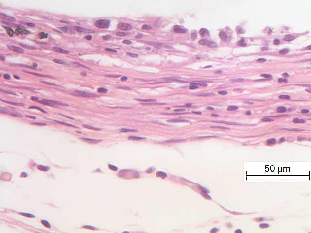 fibrocelular (estrela  (x40); Figura 15H Cimento Portland cinza
