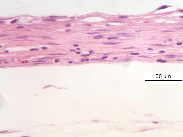 fibrocelular (estrela  (x40); Figura 15J Grupo Controle tecido