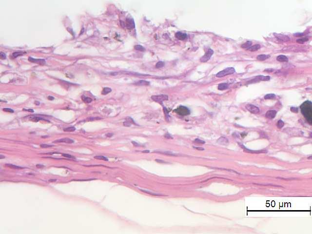 (x40); Figura 16M Cimento Portland cinza Minetti tecido fibrocelular