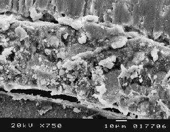 Ferreira MM et al Foram também realizadas observações ao microscópio electrónico de varrimento (MEV) para se analisar a adaptação e fendas do material de obturação às paredes dos canais radiculares