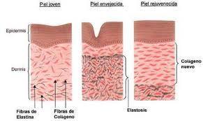 Radiofrequência A estimulação fibroblástica