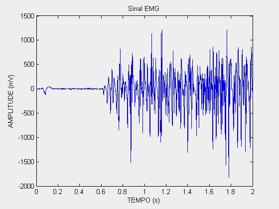 Eletromiografia (EMG) Método de