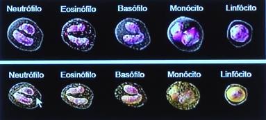 Utilização de corantes fluorescentes que se ligam ao RNA dos ribossomos nas organelas e ao DNA O laser incide na substância